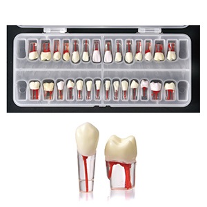 透明ルートキャナル模型