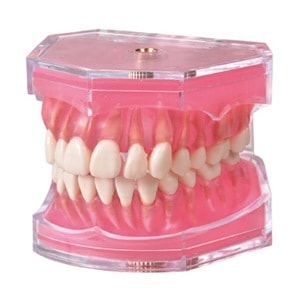 NISSIN顎模型 頬粘膜・歯石セット・顎模型ホルダー付き 値下げ済