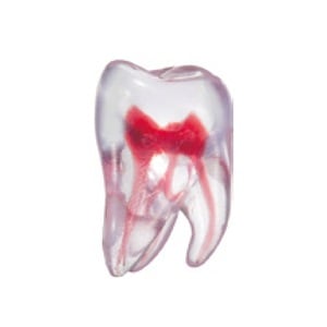 エンドトレーニング トゥース 上顎大臼歯(1-2-1)