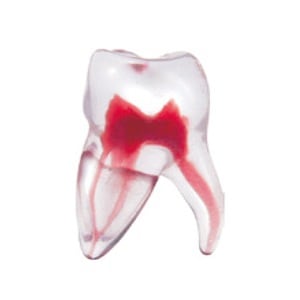 エンドトレーニング トゥース 上顎大臼歯(MB2)