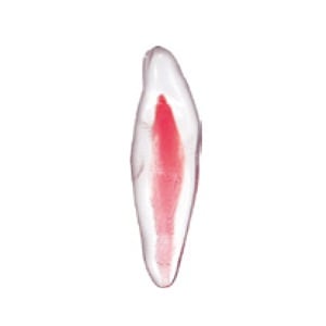 エンドトレーニング トゥース 下顎切歯