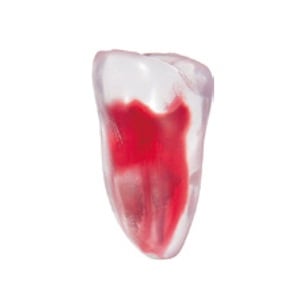 エンドトレーニング トゥース 下顎大臼歯(樋状根)