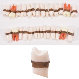 【ｾｰﾙ】SRPトレーニング模型 交換用歯牙