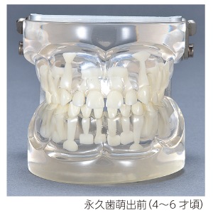 歯科模型　乳歯　　永久歯　説明用　スケルトン 送料無料】透明乳歯 永久歯交換期模型 永久歯萌出前(4～6歳頃)