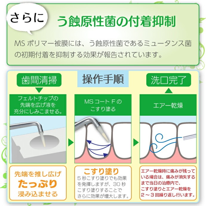 MS������F 1���å�(��ե��륻�å�) �γв�����������������̵����