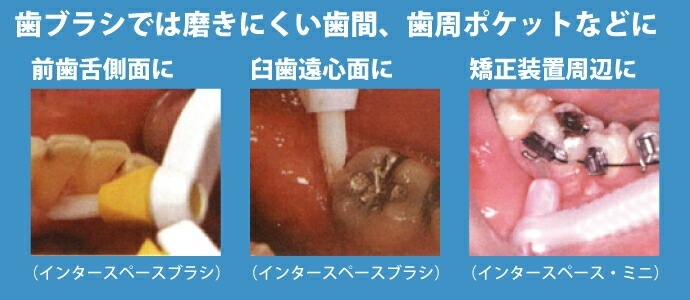 ����� ���󥿡����ڡ����֥饷 / �ߥǥ����� M 1���� / ���� / �ϥ�ɥ� /�إå��դ��ؤ�