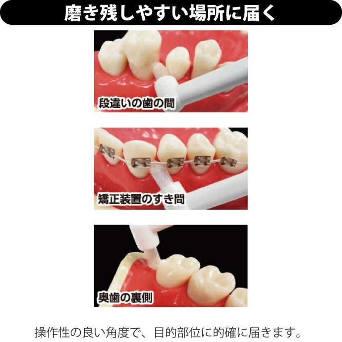 歯ブラシ ワンタフト ちょんまげブラシ やわらかめ 1本入 (EBiSU)