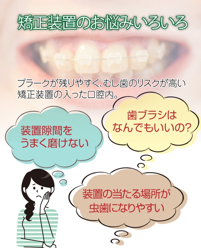 ������륱�� ���� ���֥饷 ���󥿡��֥쥤�� 1��
