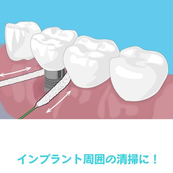 Ci �ե������꡼�ʡ� �Υ�ե졼�С� 30��/Ȣ