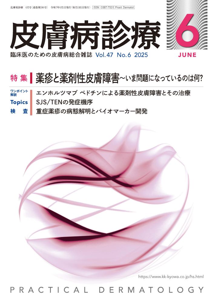 皮膚病診療2024年4月号 皮膚病診療 2025年6月号 | 月刊 皮膚病診療 | 協和企画 医書