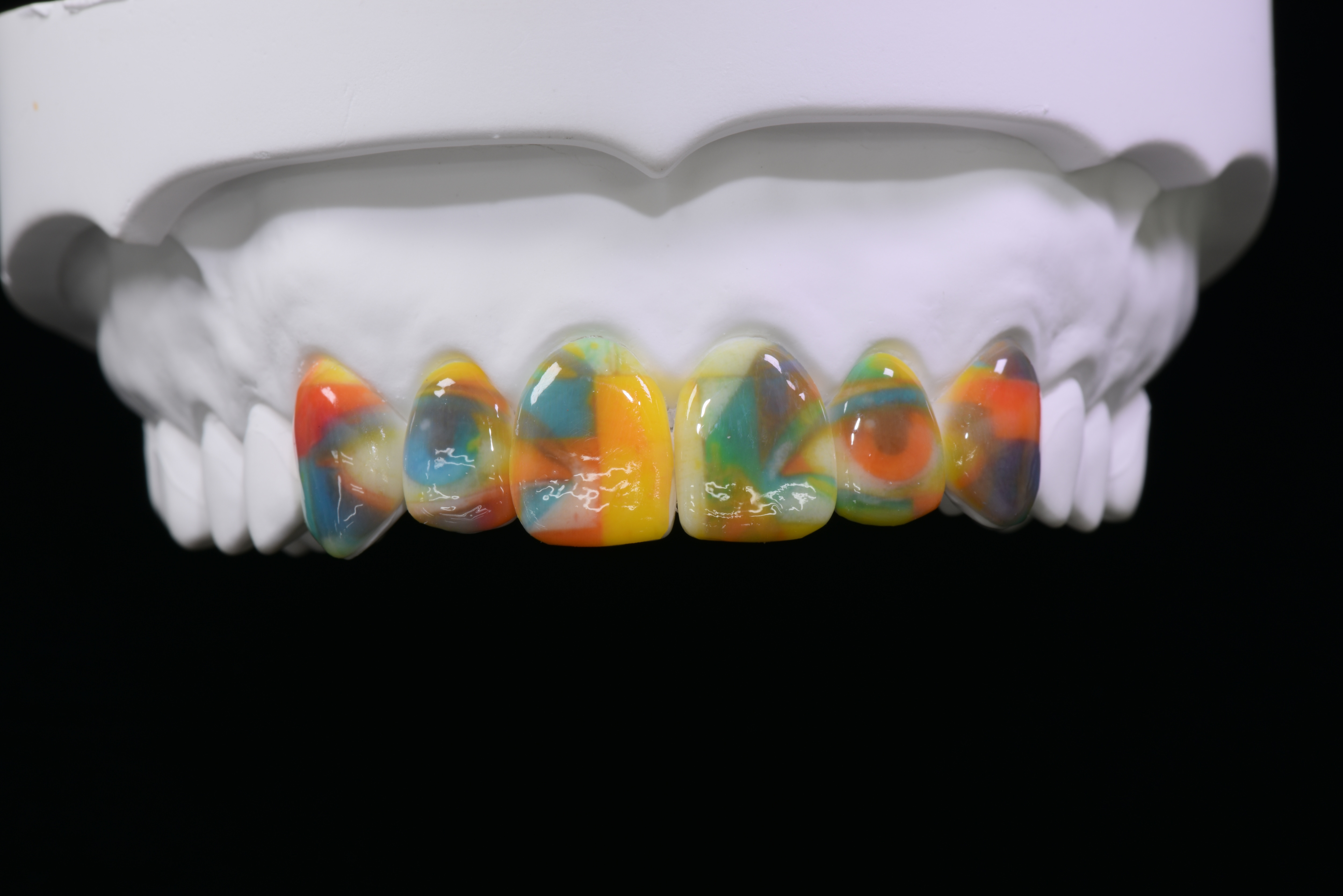 6前歯デジタルアート（ヒューマンゲイズ）