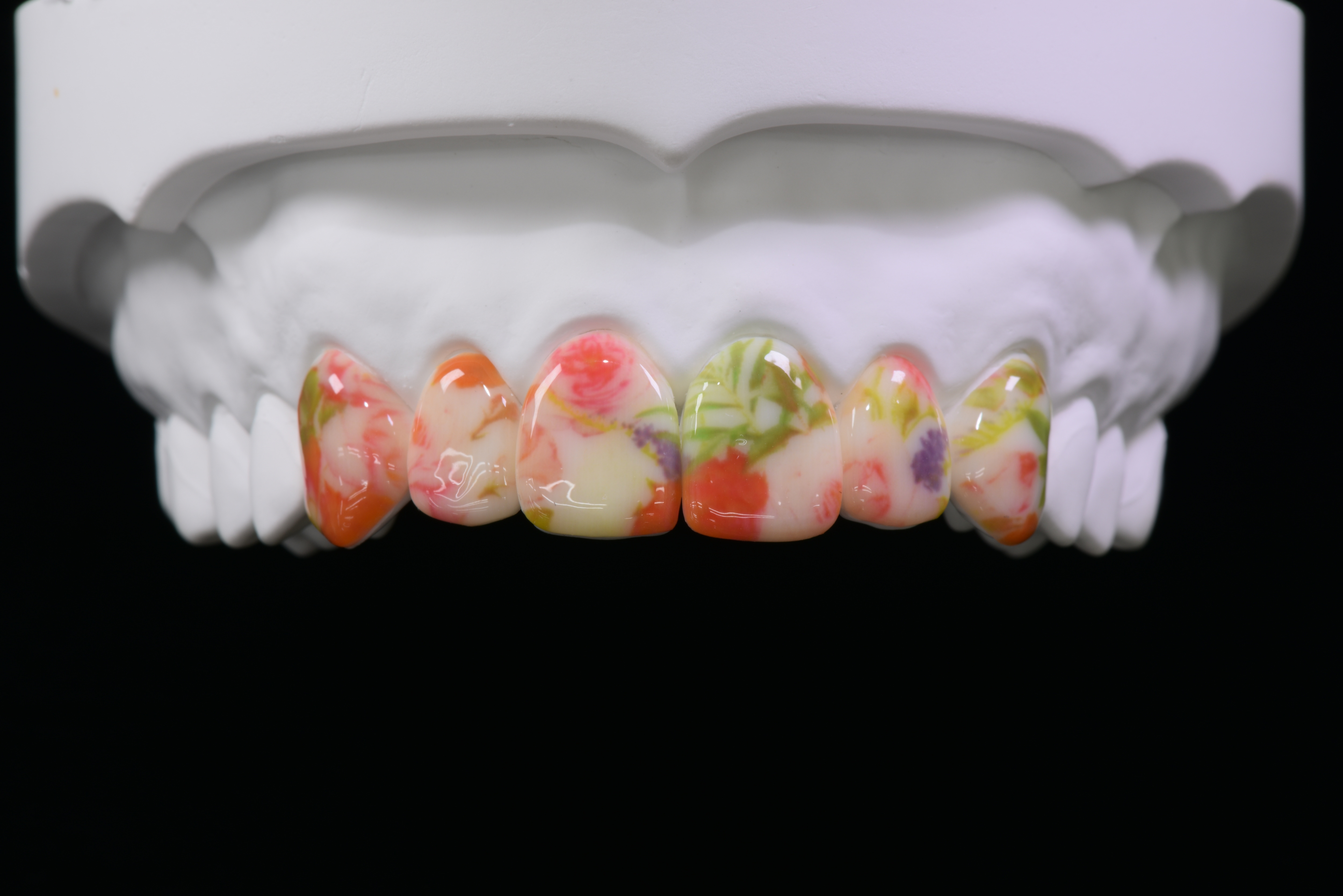 6前歯 花柄イラスト（フローラルスマイル）