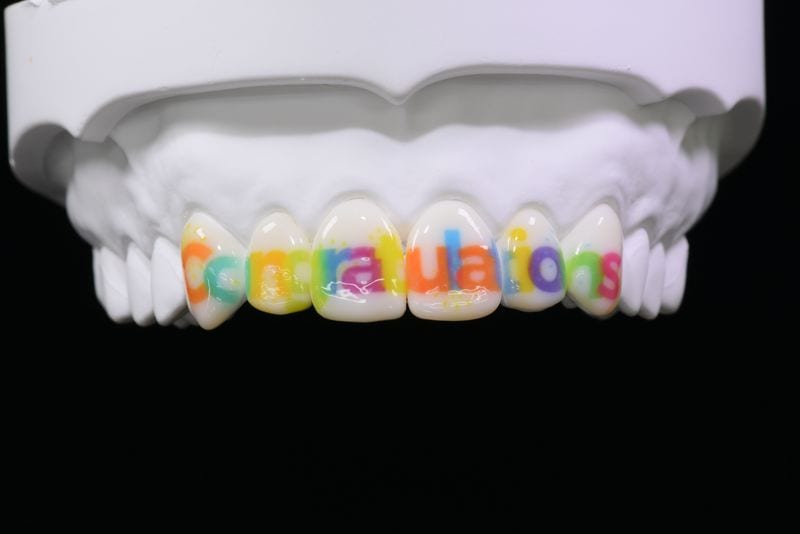 6前歯 Congraturations