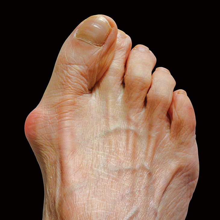 足指らーくパッド 4個組