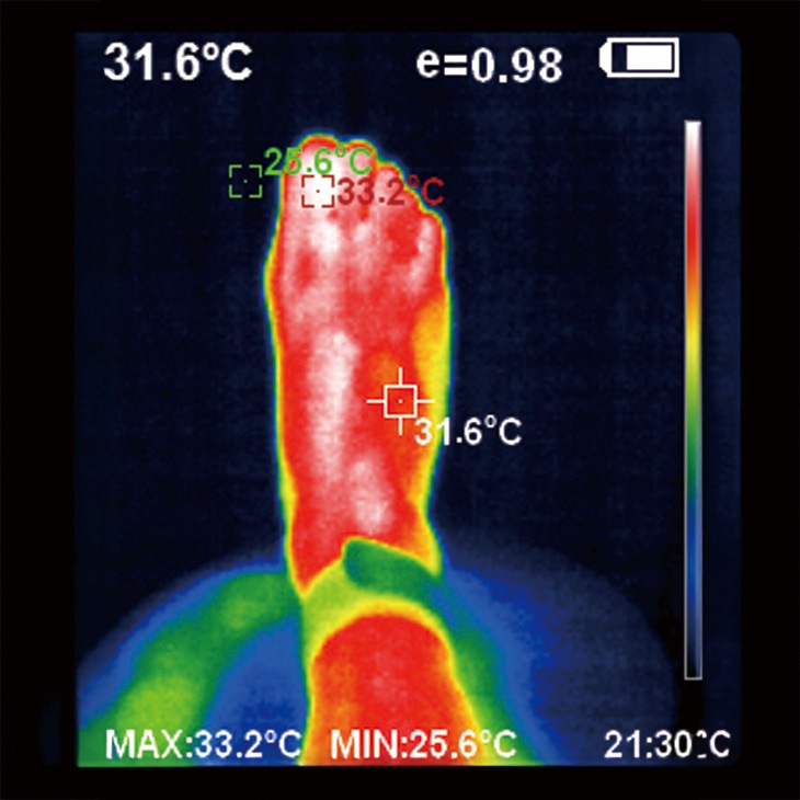 脚ツラン・ベルト2本組 レギュラー