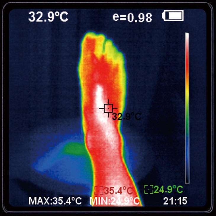 脚ツラン・ベルト2本組 ワイド