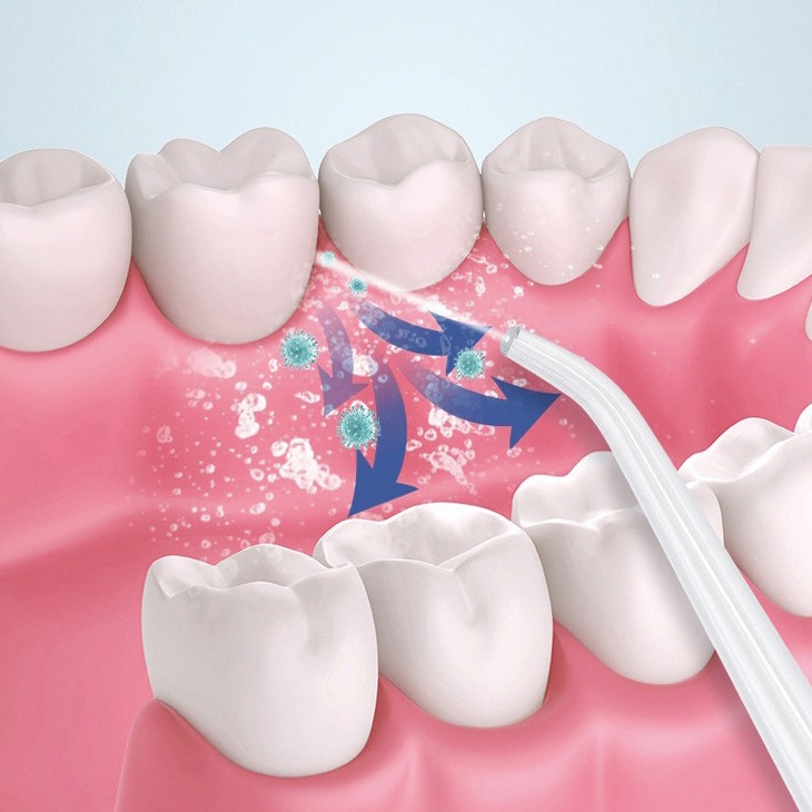 充電式口腔洗浄機