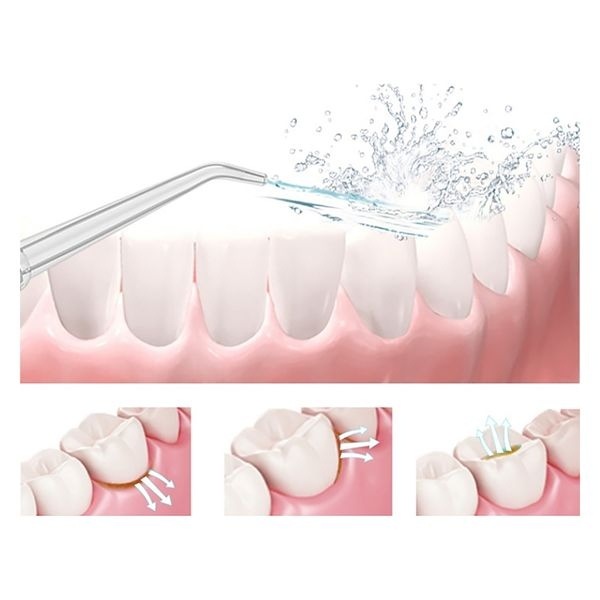 充電式口腔洗浄機