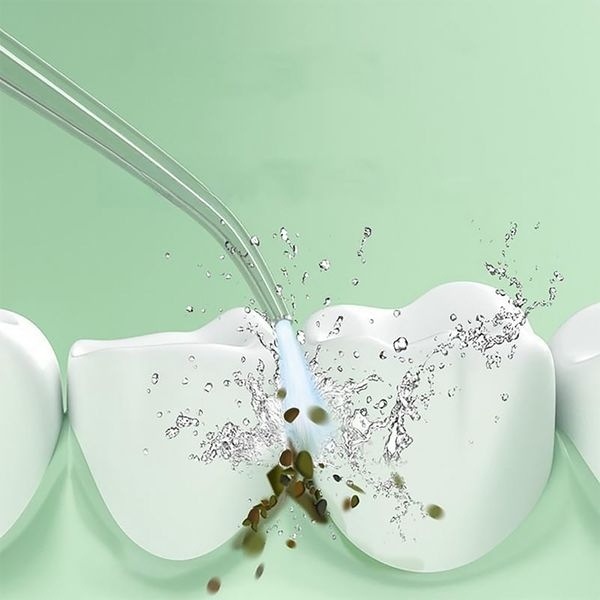 充電式口腔洗浄機