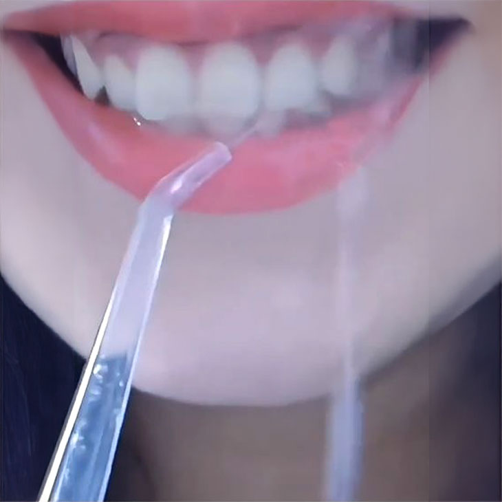 充電式口腔洗浄機