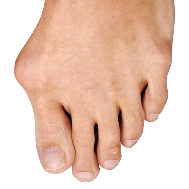 やわらゲル外反母趾足指サック 3足6個組