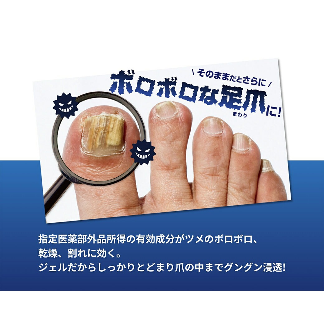 薬用足爪ジェル