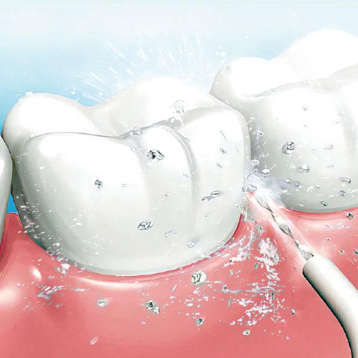 ジェット水流口腔洗浄器 ACアダプター付き