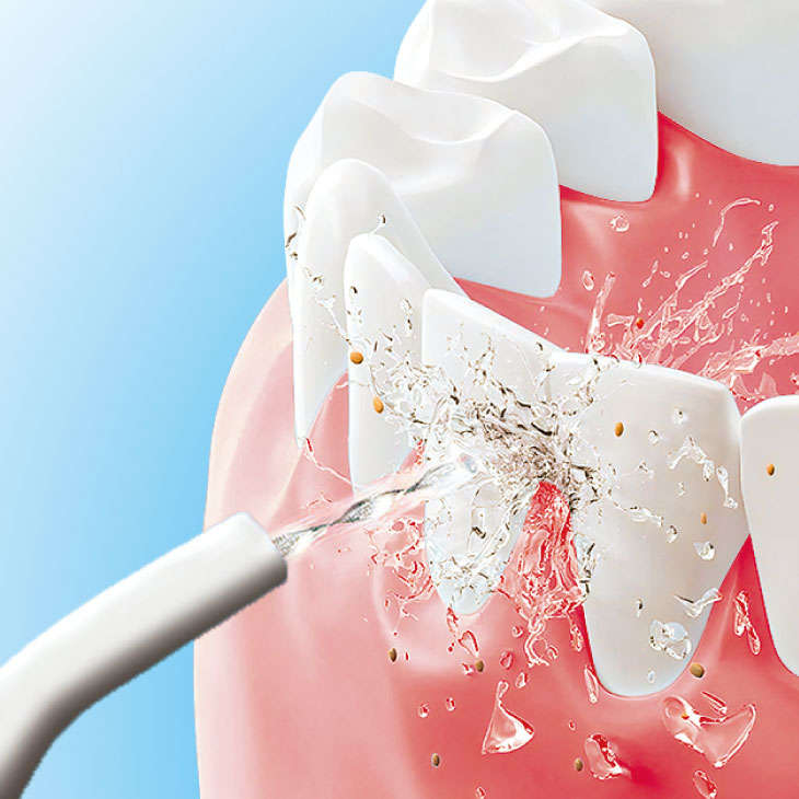 ジェット水流口腔洗浄器 ACアダプター付き