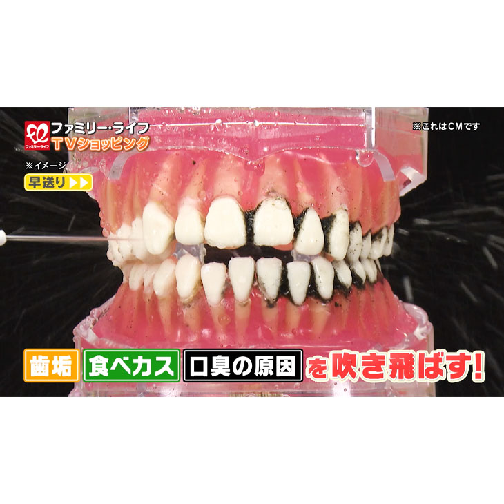 ジェット水流口腔洗浄器 ACアダプター付き