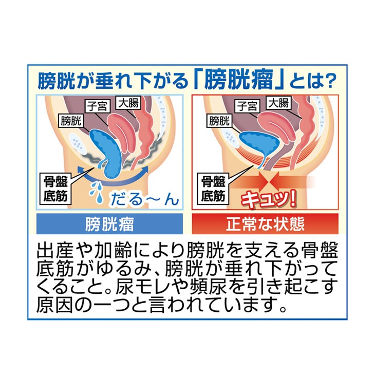 一般医療機器 骨盤底筋ベルト モレナレディEX