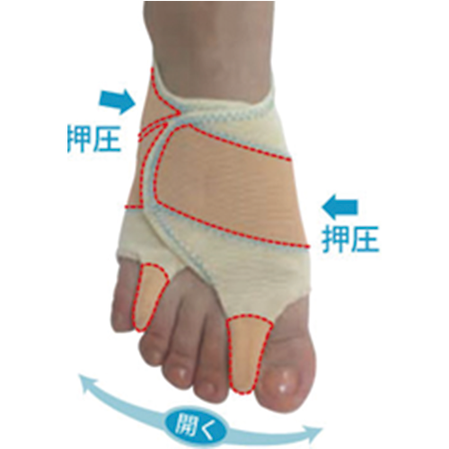 【Sale在庫限り】外反内反Ｗサポーター『指間パットタイプ』（左足/片足入り）AKC-001-Sale