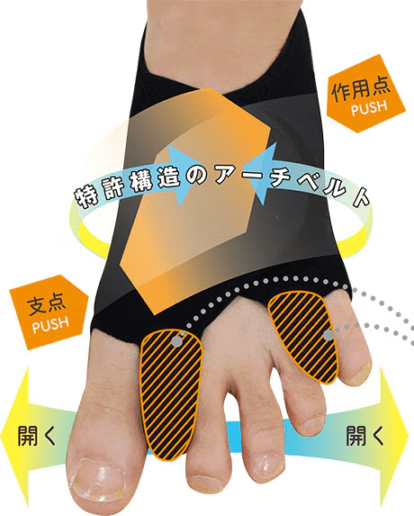 【まとめ買い割引対象商品】外反内反Ｗサポーター『指間パットタイプ』（片足入り/左右別売り）AKC-010