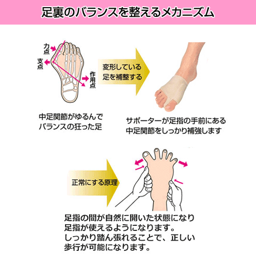 ソルボ外反母趾サポーター「薄型」（左右別売り）SOL-100/