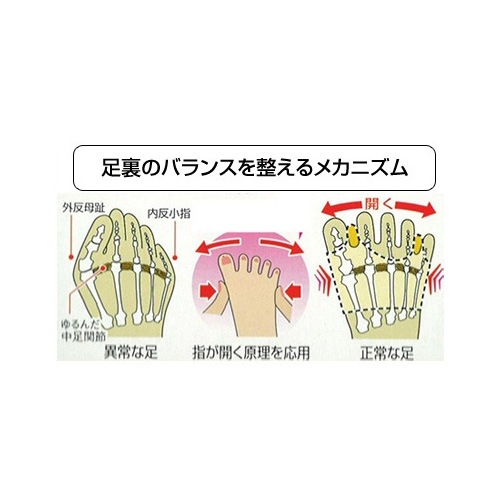 ソルボ外反母趾・内反小指サポーター「固定型薄型メッシュタイプ」（左右別売り）SOL-300/
