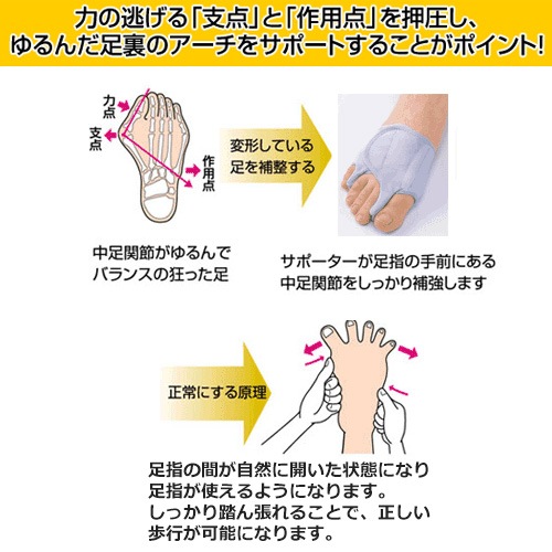 ソルボ外反母趾・内反小指サポーター「固定型薄型メッシュタイプ」（左右別売り）SOL-300/
