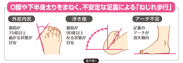 【限定】美整体シリーズ　ひざまっすぐ【スリムサポーター】両足入り/AKM-002【期間限定プレゼント企画】