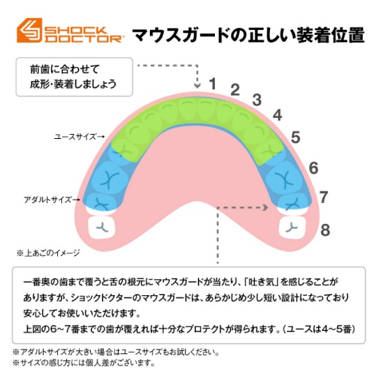 ShockDoctor ショックドクター マウスガード 9290Y スーパーフィット クリア ユース