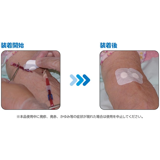 ���륮�͡��ȥѥå� 30��/Ȣ