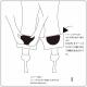 SUSOPA(��Ƨ���ɻߥѥå� )HEART��ȴ�������� 3SET