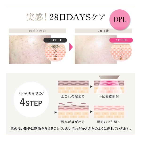 在庫あり 脱毛器 光美容器 WAVEWAVE Radiant Grace 家庭用 光脱毛器