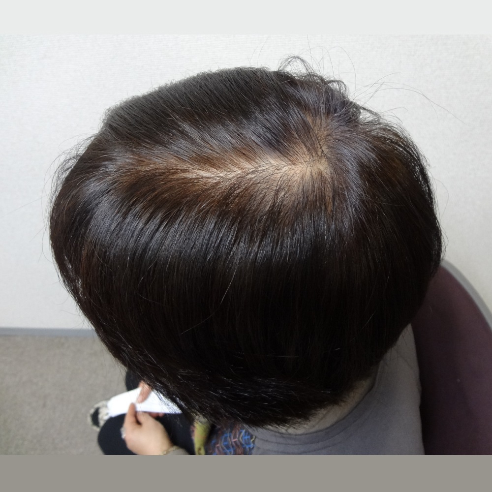 �ǥ����ץ֥饦��������ᡦ��������� ���꡼��Ρ��ȥإ� �������ˡ���