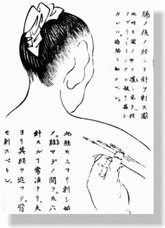 諾�����