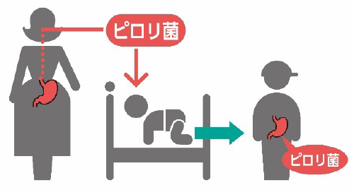 胃がんリスク層別化検査(ABC分類） | すべての商品 | i-cell market