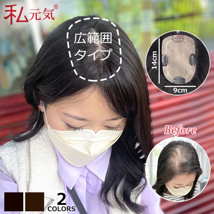 公式】私元気ウィッグ専門店 | 【ひゃんさんご紹介ウィッグ】【大面積