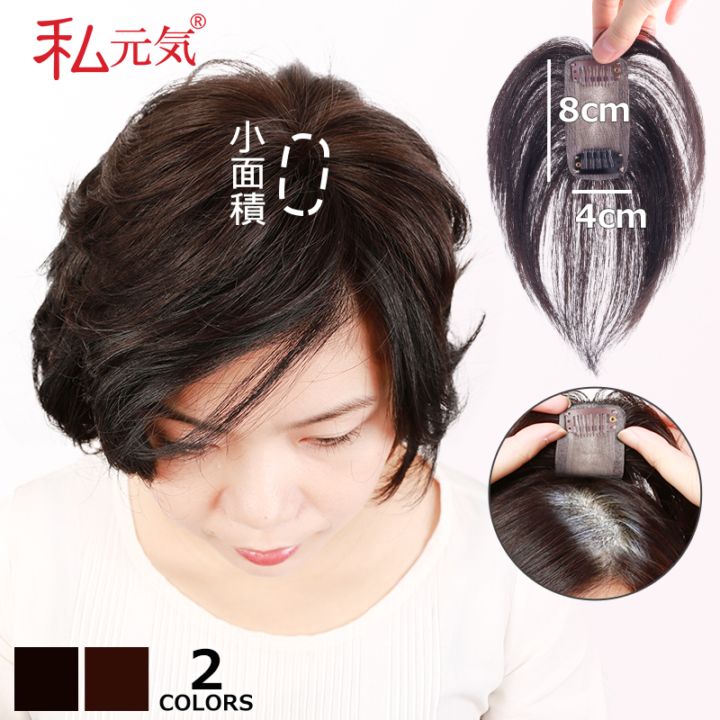 私元気　頭頂部部分ウイッグ　黒 私元気 頭頂部部分ウイッグ 黒 【小面積 4×8cm】通気性 超軽量 夏用