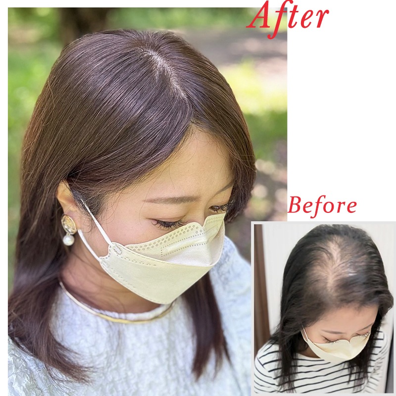  812cmۥߡإ  ̵ ʬܼͳ ʼ 꿢 ʬå 30cm 35cm 40cm إԡ ȱ Ĥ ꥢ ȥåץС Ƭĺ к