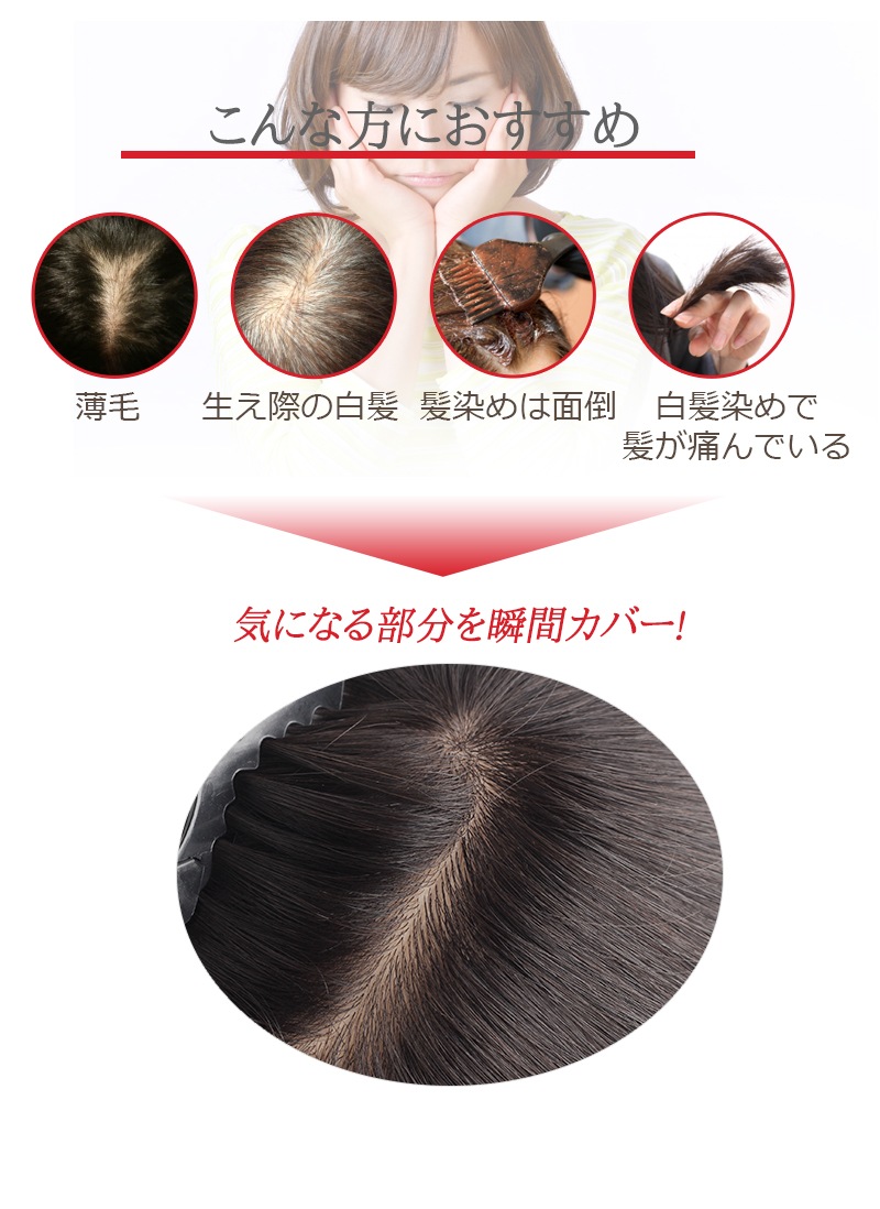 公式】私元気ウィッグ・かつら専門店 | 人毛 部分ウィッグ 艶髪 公式】私元気ウィッグ・かつら専門店 | 人毛 部分ウィッグ 艶髪