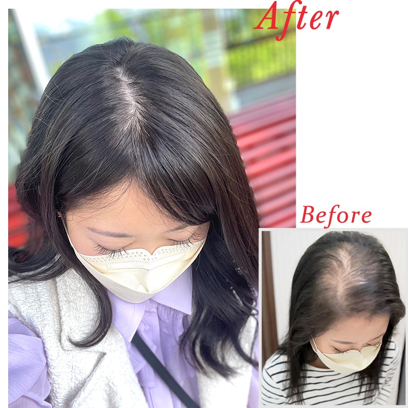 Ҥ󤵤Ȼ丵Ʊȯ  914cmۼ ̵ ʬܼͳ ߡإ 꿢 ʬå 40cm إԡ ȱ ʼ Ĥ ꥢ ȥåץС Ƭĺ к