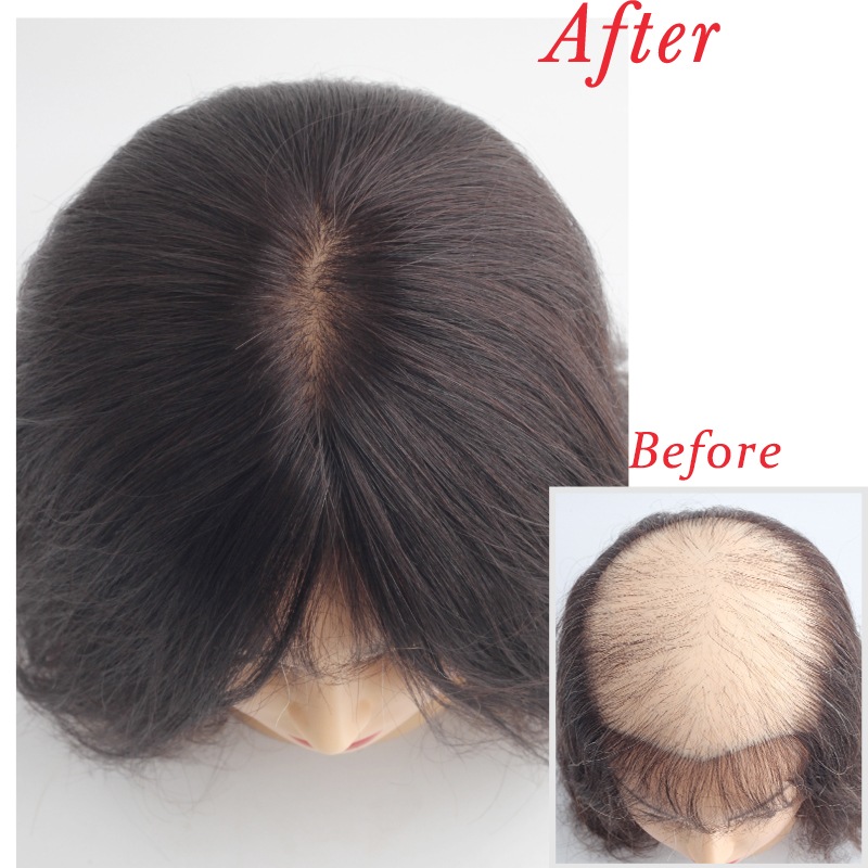 ���������� 16��18cm�ۼ��� �̵���  ����  ʬ���ܼ�ͳ ���ʼ����� ���꿢�� ��ʬ�����å� �إ��ԡ��� �ݥ���ȥ����å� �ȥåץ��С� ���� �ܥ�塼�� ���� Ƭĺ�� ��Ƭ�� ������ ���ϰϥ��С� ��ȱ������ ��ȱ���С� �����к�