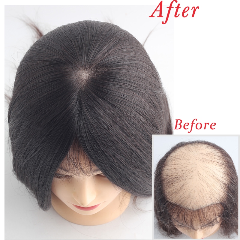 �㸫�� ��ߡ��إ����������� 16��18cm�ۼ��� �̵��� ʬ���ܼ�ͳ ���ʼ����� ���꿢�� ��ʬ�����å� �إ��ԡ��� ���ϰϥ��С� ��ȱ������ �Ĥ��� �ꥢ�� �ȥåץ��С� Ƭĺ�� �����к�